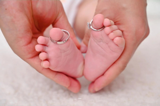 保定孕妇怎样预防妊娠纹